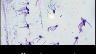 Structural stains Endospore capsule and flagella [upl. by Shaver777]