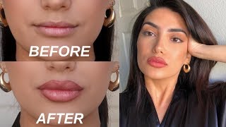 HOW TO FAKE BIG LIPS IN 3 EASY STEPS OMG [upl. by Gleeson]