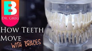 BRACES EXPLAINED How Teeth Move  Braces Work [upl. by Kori201]