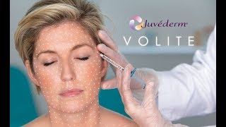 How to hydrate your skin from the inside out with Juvederm Volite at BC laser [upl. by Boorer]