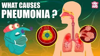 PNEUMONIA  What Is PNEUMONIA  Respiratory Disease  The Dr Binocs Show  Peekaboo Kidz [upl. by Weasner]