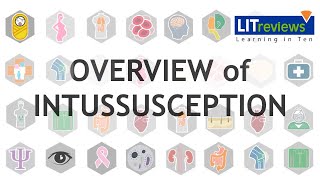 Overview of Intussusception [upl. by Reisch]