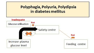 Polyuria Polyphagia Polydipsia in Diabetes mellitus [upl. by Akirdnahs671]