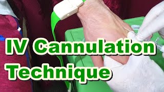 How to Insert IV Cannula  IV Cannulation Technique  Branula  Intravenous Catheter [upl. by Reynolds]