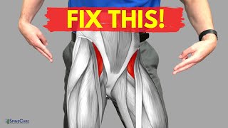 How to Relieve Hip Flexor Pain in 30 SECONDS [upl. by Silrak540]