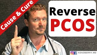 PCOS What Causes PCOS How to Reverse PCOS [upl. by Llennoj]