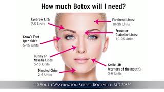 Basics of Botox Injection [upl. by Jennine]