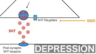 Major Depression and SSRIsSNRIs [upl. by Eittel274]