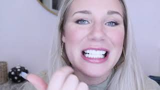 REMOVABLE VENEERS USA REVIEW NYC Emily [upl. by Atirehc]