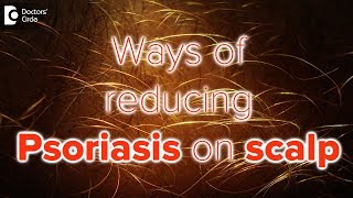 What helps psoriasis on scalp  Dr Rasya Dixit [upl. by Jelle]