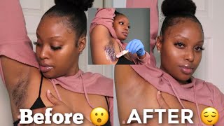 WAX Your Underarms AT HOME  How To Lighten Dark Underarms Naturally Detailed [upl. by Ahsieket]