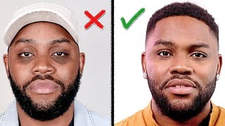 Remove DARK CIRCLES Under Your Eyes How I Did It Mens Skin Care [upl. by Skantze]