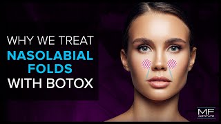 Botox Injections  Anatomy and Technique [upl. by Barbee]