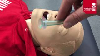 Nasopharyngeal Airway Insertion [upl. by Onilecram]