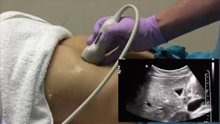 Ultrasound of Lumps and Bumps [upl. by Alekal]