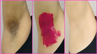 How To Lighten Dark Underarms PERMANENTLY  100 Naturally  Anaysa [upl. by Ahsap]