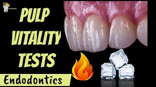 ENDODONTICS  PULP VITALITY TESTS MADE EASY [upl. by Nerrak]