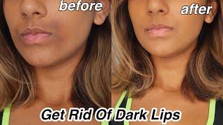 How To Get rid Of Dark Lips And Pigmentation [upl. by Luciana90]