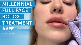 Classic Millennial Full Face Botox Treatment  AAFE [upl. by Ylrad]