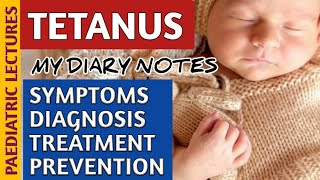 Tetanus In Neonates amp Children  Lock Jaw  Symptoms Treatment amp Prevention [upl. by Onstad]