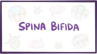 How do we treat spina bifida after a babys birth [upl. by Repip628]