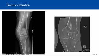 Introduction to Musculoskeletal Radiology [upl. by Hamid769]