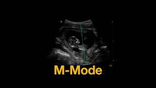 Measuring Fetal Heart Rate [upl. by Naresh734]