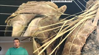 Brachial Plexus EXPLAINED Using a Cadaver [upl. by Ahsirtap]