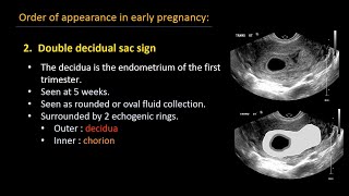 Ultrasound of normal early pregnancy [upl. by Enegue942]