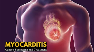 Myocarditis Causes Signs and Symptoms Diagnosis Treatment [upl. by Crispa811]