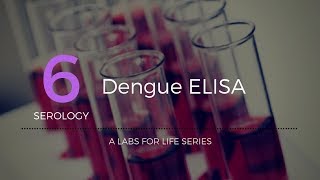 Dengue ELISA [upl. by Naltiac]