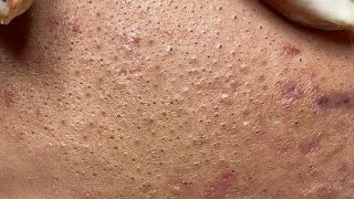 Satisfying Hien Spa Beauty Relaxing Video 28 [upl. by Isobel963]