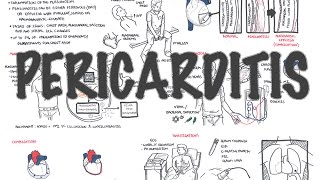 Echocardiography Essentials Detecting pericardial effusions [upl. by Annohsat]