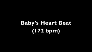 Fetal Heart Beat Audio 11 Weeks Pregnant [upl. by Ieso991]