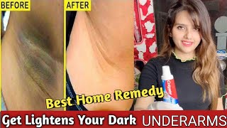 Home Remedy Tips UnderArms WhiteningRid Dark Spotsamp Patches Skincare tipFalak Naaz FalakNaaz [upl. by Ailee796]