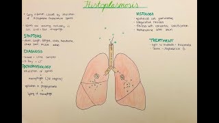 Histoplasmosis  pathophysiology histology clinics [upl. by Dolphin410]