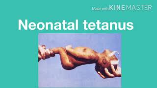 Neonatal tetanus [upl. by Brigitte]