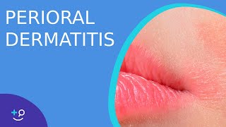 Perioral Dermatitis  Daily Dos of Dermatology [upl. by Solhcin]