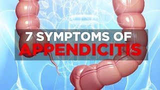 Appendix Surgery Appendicitis symptoms and what to expect from Appendectomy [upl. by Evette]