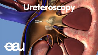 Welcome to my channel  Dr Rena Malik  Female Urologist [upl. by Ahsar251]