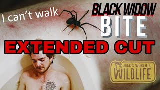 Black Widow BITE The EXTENDED CUT [upl. by Frannie311]