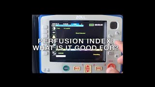 Perfusion Index what is it good for Absolutely something [upl. by Maisel]