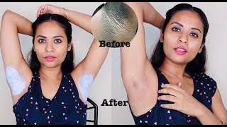 Live Result In Just 10 minutes Dark Underarm Whitening 100 Works [upl. by Atela366]