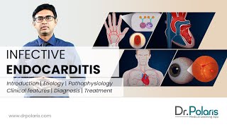 INFECTIVE ENDOCARDITIS  Etiology Pathophysiology Clinical Features Management  Animated [upl. by Roberson]