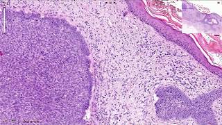 Basal Ganglia Direct vs Indirect Pathways [upl. by Elleinnad]