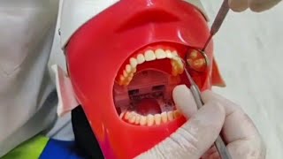 Scaling Teeth Manual amp Type Of Rest شرح بالتفصيل [upl. by Kerman]