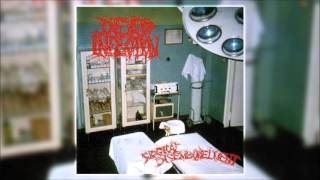 Dead Infection  Surgical Disembowelment 1993 FULL ALBUM [upl. by Zobkiw]