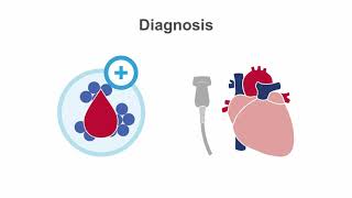 Endocarditis 101 Diagnosis and Treatment [upl. by Aicac793]