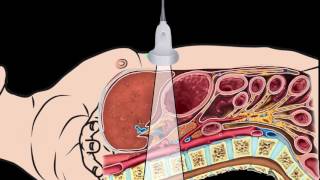 How I do it Ultrasound of the Abdomen [upl. by Chesnut365]