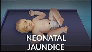 Neonatal Jaundice by L Veit  OPENPediatrics [upl. by Anivol]